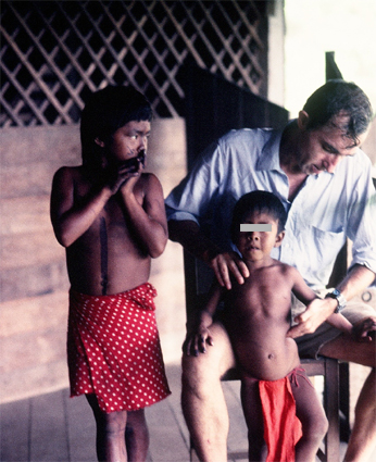 paludisme enfant guyane